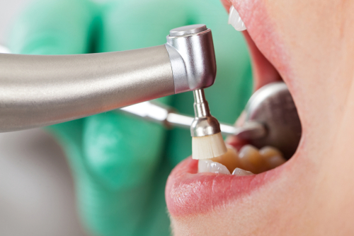 Image for our FAQ on What is a Typical Day for a Dental Hygienist?